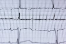 electrocardiograma_pexels-photo-415779